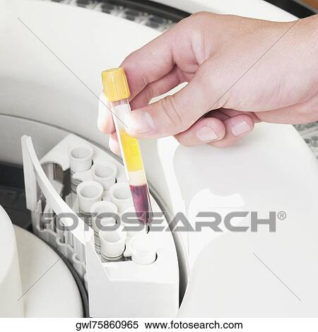 Lab technician putting a blood sample in the laboratory freezer View Large Photo Image Stock Photography - Lab technician putting a blood sample in the laboratory freezer. Fotosearch
