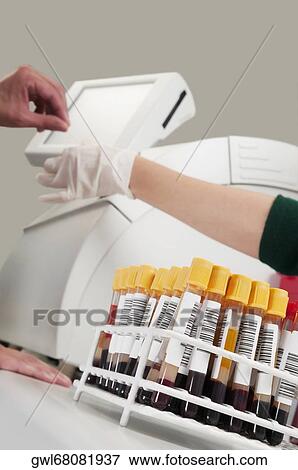Lab technician testing a blood samples in a laboratory View Large Photo Image Stock Photo - Lab technician testing a blood samples in a laboratory. Fotosearch