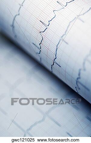 Close-up of a line graph on a chart View Large Photo Image Stock Photography - Close-up of a line graph on a chart. Fotosearch