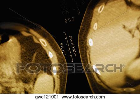 Close-up of an MRI scan View Large Photo Image Stock Image - Close-up of an MRI scan. Fotosearch