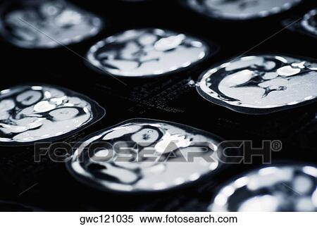 Close-up of an MRI Scan View Large Photo Image Stock Photography - Close-up of an MRI Scan. Fotosearch