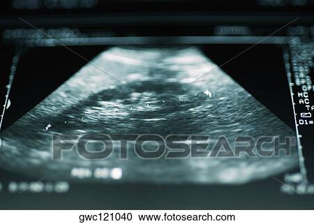 Close-up of an ultrasound View Large Photo Image Stock Image - Close-up of an ultrasound. Fotosearch