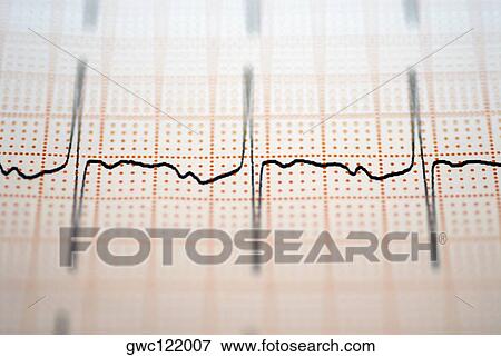 Close-up of an ECG report View Large Photo Image Stock Photo - Close-up of an ECG report. Fotosearch