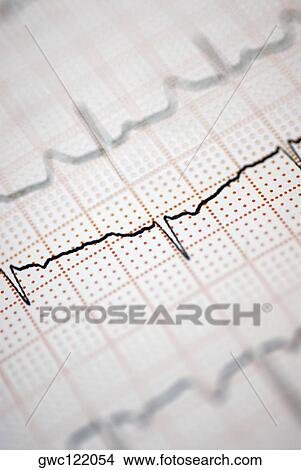 Picture - Close-up of an electrocardiogram report. Fotosearch