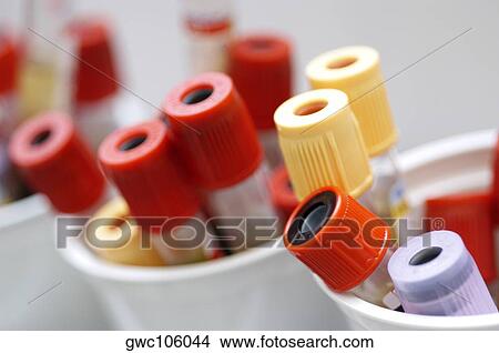 Close-up of test tubes in containers View Large Photo Image Picture - Close-up of test tubes in containers. Fotosearch