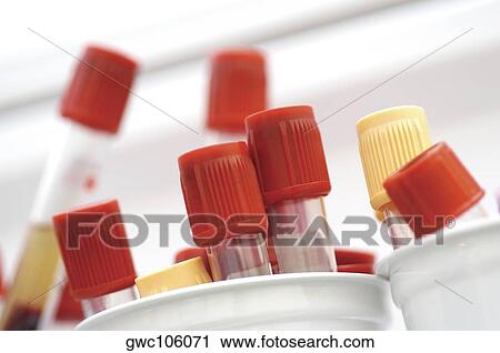 Close-up of vials in containers View Large Photo Image Stock Image - Close-up of vials in containers. Fotosearch