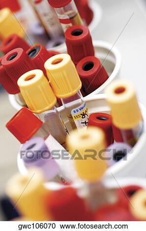 High angle view of vials in containers View Large Photo Image Stock Image - High angle view of vials in containers. Fotosearch