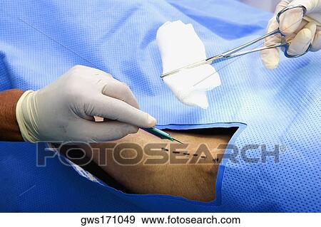 Stock Photo - Close-up of two surgeons operating a patient. Fotosearch