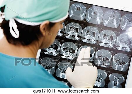 Rear view of a surgeon looking at an X-Ray View Large Photo Image Stock Image - Rear view of a surgeon looking at an X-Ray. Fotosearch