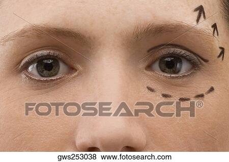 Close-up of a young woman with pre-surgical markings on her face View Large Photo Image Stock Photo - Close-up of a young woman with pre-surgical markings on her face. Fotosearch