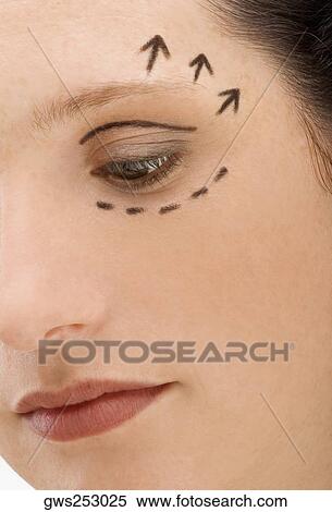 Close-up of a young woman with pre-surgical markings on her face View Large Photo Image Stock Photography - Close-up of a young woman with pre-surgical markings on her face. Fotosearch