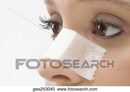 Close-up of an adhesive bandage on a patient's nose View Large Photo Image Stock Image - Close-up of an adhesive bandage on a patient's nose. Fotosearch