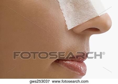 Stock Photo - Close-up of an adhesive bandage on a patient's nose. Fotosearch