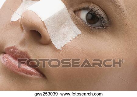 Close-up of an adhesive bandage on a patient's nose View Large Photo Image Stock Photo - Close-up of an adhesive bandage on a patient's nose. Fotosearch