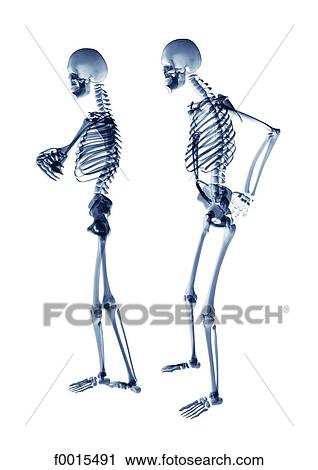 Stock Image - Skeletons: fight. Fotosearch