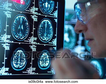Doctor viewing brain scans for possible disease or damage in clinic View Large Photo Image Stock Image - Doctor viewing brain scans for possible disease or damage in clinic. Fotosearch