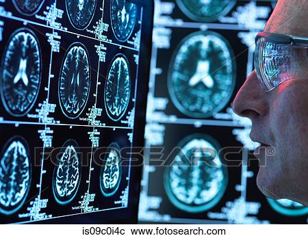 Stock Image - Doctor viewing brain scans for possible disease or damage in clinic. Fotosearch