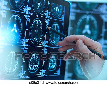 Stock Image - Doctor viewing brain scans for possible disease or damage in clinic. Fotosearch