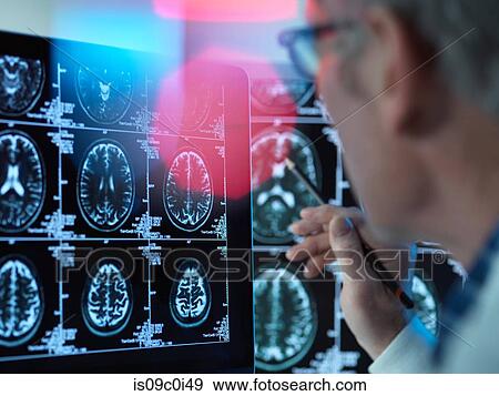 Doctor viewing brain scans for possible disease or damage in clinic View Large Photo Image Stock Photo - Doctor viewing brain scans for possible disease or damage in clinic. Fotosearch
