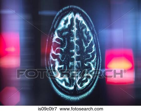 Stock Photo - Refection of MRI brain scan on monitor display. Fotosearch