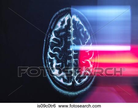 Refection of MRI brain scan on monitor display View Large Photo Image Stock Photograph - Refection of MRI brain scan on monitor display. Fotosearch