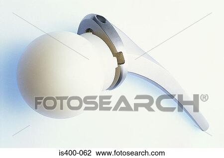 Hip replacement View Large Photo Image Stock Image - Hip replacement. Fotosearch