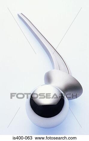 Hip replacement View Large Photo Image Stock Image - Hip replacement. Fotosearch