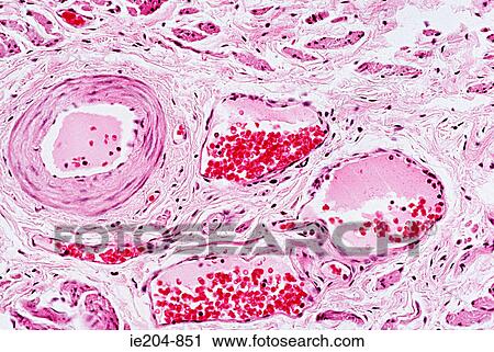 Stock Image - Blood vessels. Fotosearch