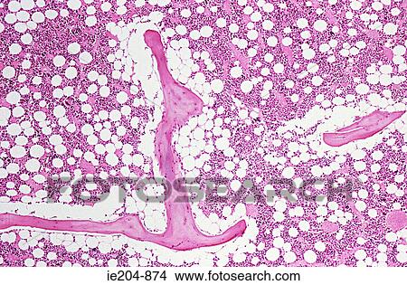 Bone marrow View Large Photo Image Picture - Bone marrow. Fotosearch