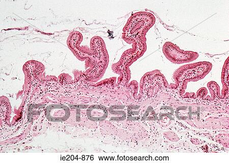 Bone marrow View Large Photo Image Stock Photograph - Bone marrow. Fotosearch