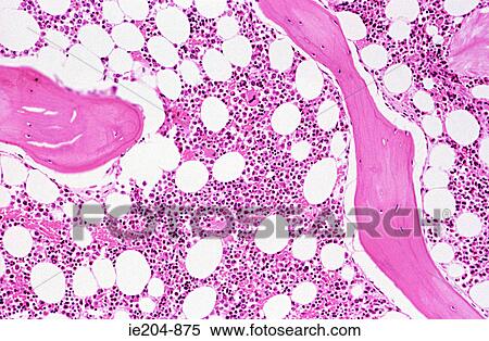 Bone marrow View Large Photo Image Stock Photography - Bone marrow. Fotosearch