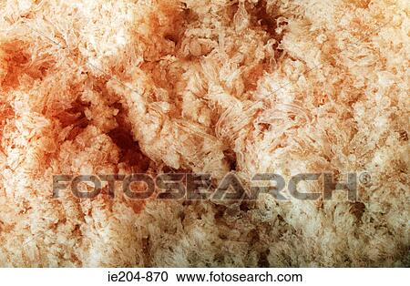 Stock Image - Chorionic villi in pregnancy. Fotosearch
