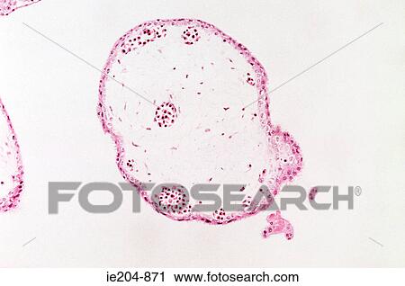 Chorionic villus View Large Photo Image Stock Image - Chorionic villus. Fotosearch