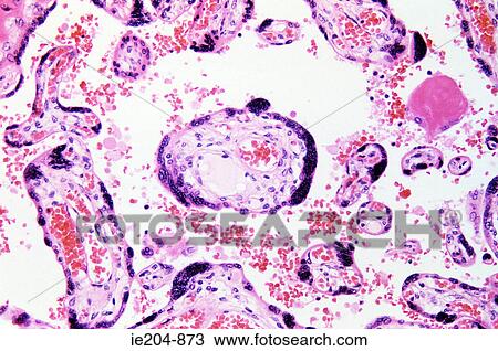 Chorionic villus View Large Photo Image Stock Image - Chorionic villus. Fotosearch