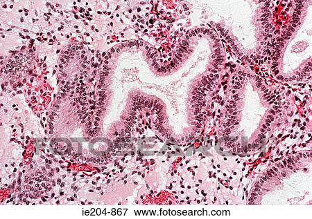 Endometrium View Large Photo Image Stock Photo - Endometrium. Fotosearch