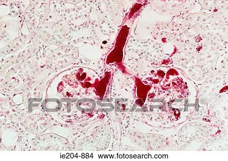 Kidney View Large Photo Image Picture - Kidney. Fotosearch