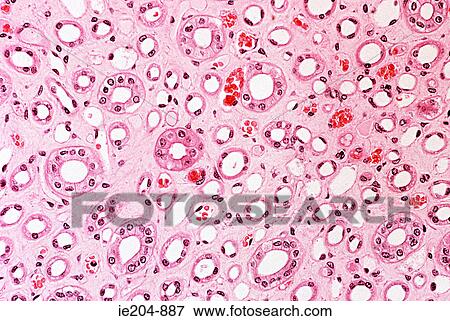 Stock Photo - Kidney. Fotosearch