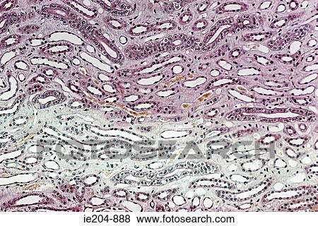 Kidney View Large Photo Image Stock Photo - Kidney. Fotosearch