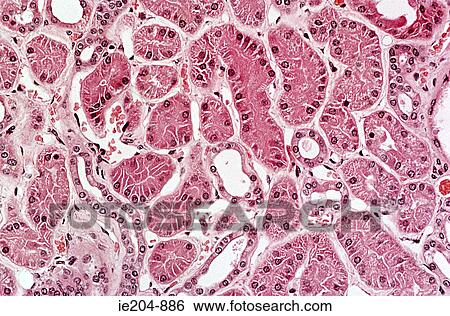 Kidney View Large Photo Image Stock Photograph - Kidney. Fotosearch