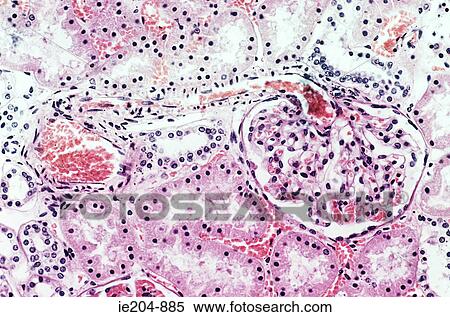 Stock Photography - Kidney. Fotosearch