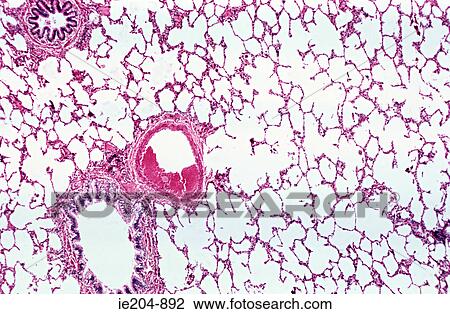 Stock Image - Lung. Fotosearch