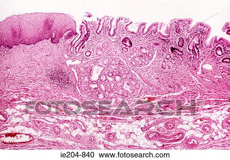 Stock Image - Oesophagus. Fotosearch