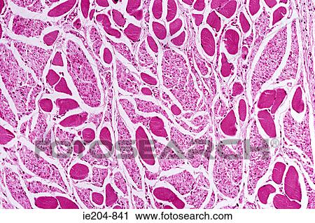 Oesophagus View Large Photo Image Stock Image - Oesophagus. Fotosearch