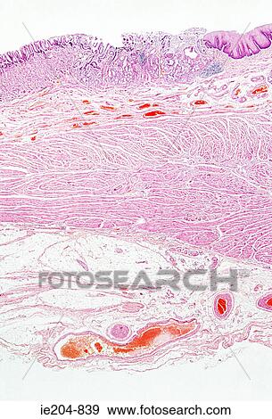 Oesophagus View Large Photo Image Stock Photo - Oesophagus. Fotosearch