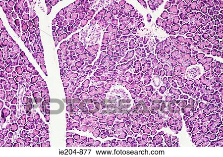 Stock Photo - Pancreas. Fotosearch