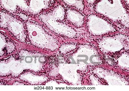Stock Image - Prostate. Fotosearch