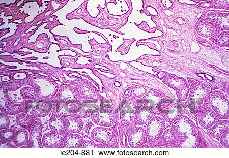 Testis View Large Photo Image Stock Image - Testis. Fotosearch