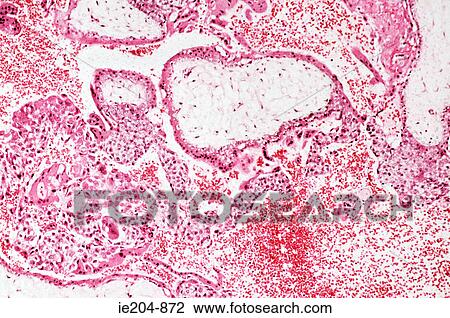 Stock Image - Trophoblasts. Fotosearch