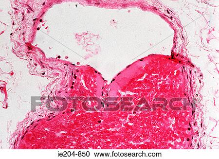 Stock Image - Vein. Fotosearch