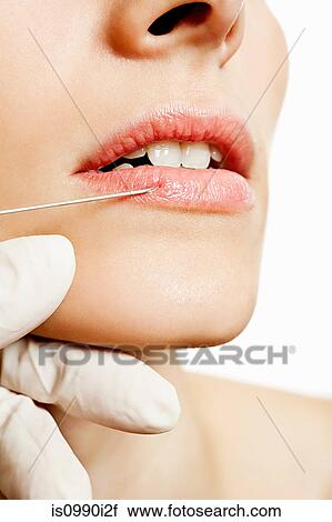 Young woman having lip injection View Large Photo Image Stock Image - Young woman having lip injection. Fotosearch